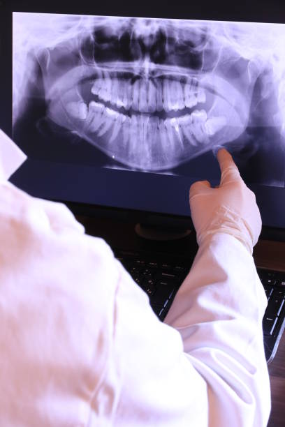 Best Knocked-Out Tooth (Avulsed Tooth) Treatment in Hinton, OK