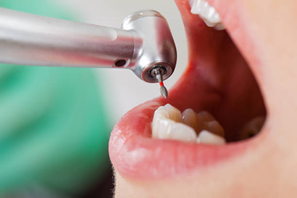 Best Weekend Emergency Dental Services in Hinton, OK